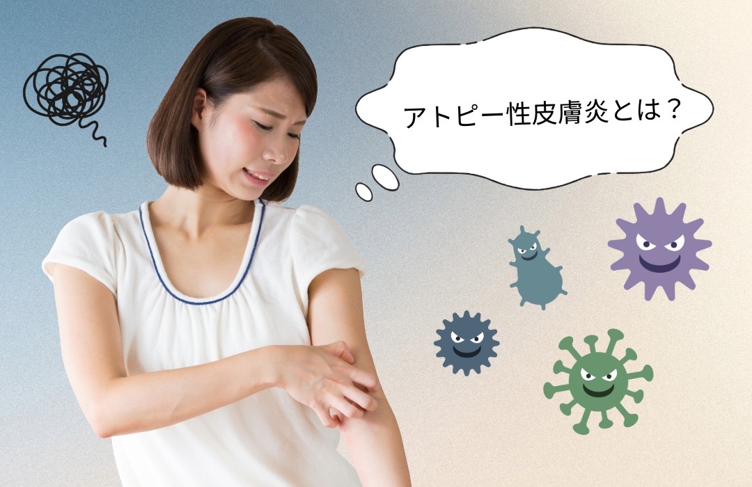アトピー性皮膚炎とは？